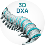 Технология 3D-DXA