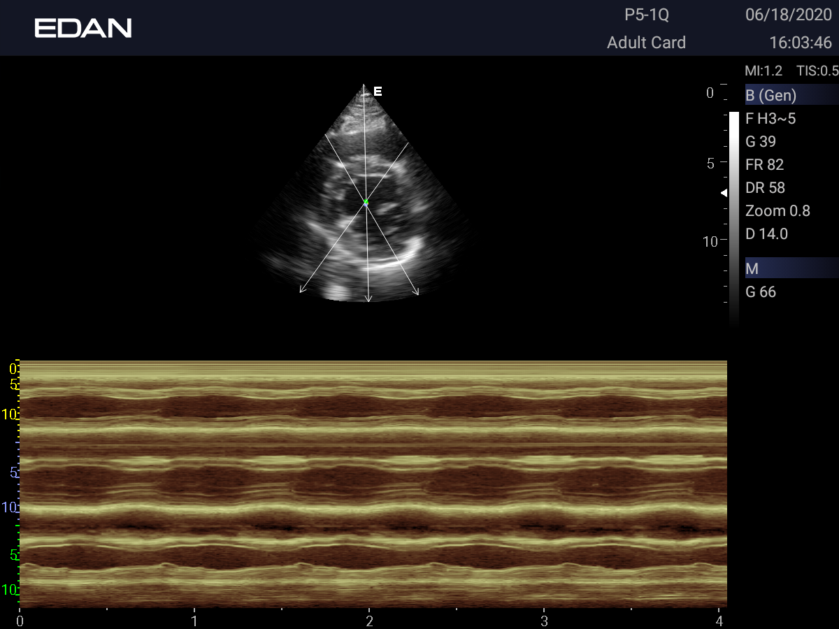 Anatomic M