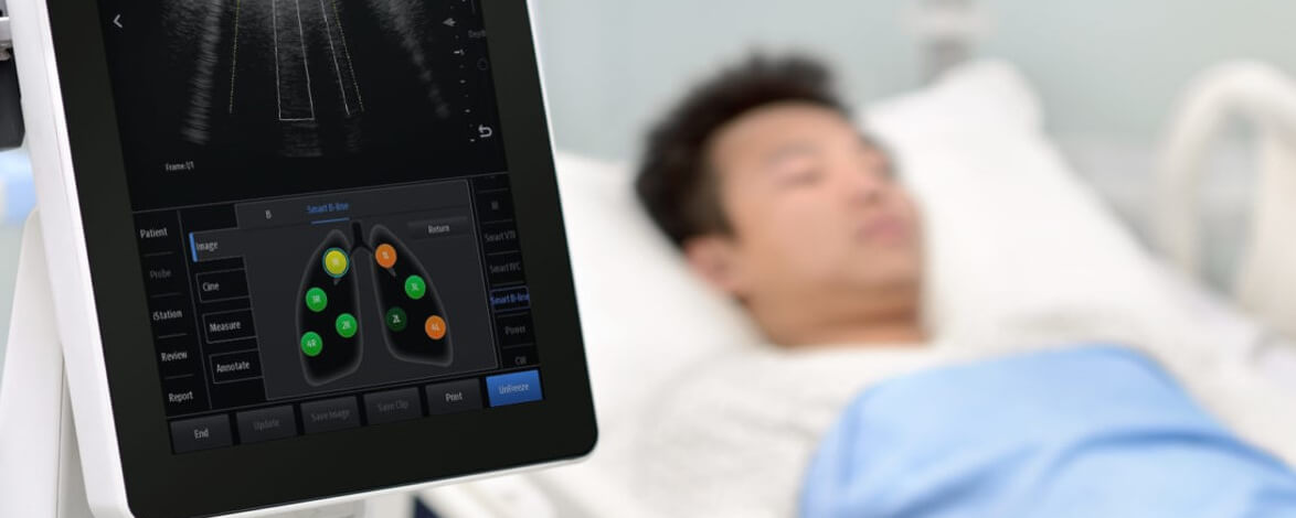 Протокол POCUS BLUE для экстренной ультразвуковой оценки легких у постели пациента