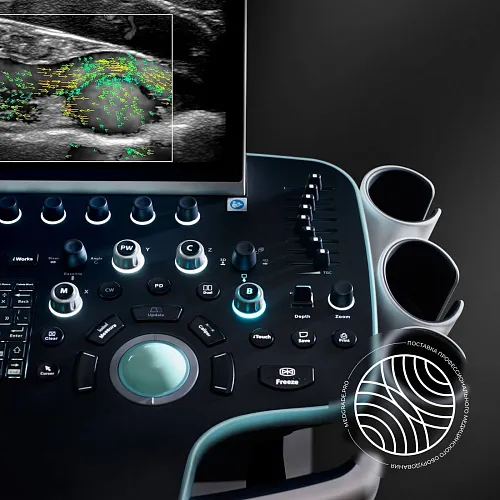 Ультразвуковой сканер Mindray Resona 7s