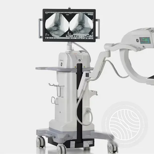 Цифровая мобильная система с С-дугой GE HealthCare OEC MiniView 